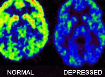 Neuroimagem